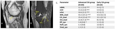 Biomarkers in Painful Symptomatic Knee OA Demonstrate That MRI Assessed Joint Damage and Type II Collagen Degradation Products Are Linked to Disease Progression